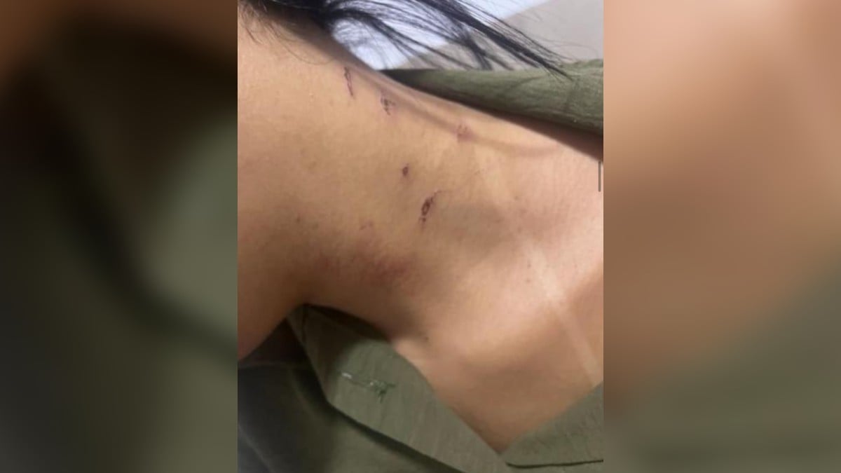 Homem é suspeito de agredir e ameaçar garota de programa em Anápolis após se apaixonar por ela (Foto: Reprodução)